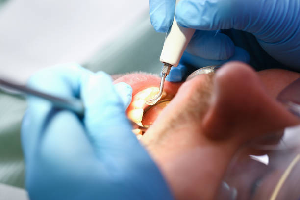 Best Emergency Root Canal Treatment in Harleysville, PA